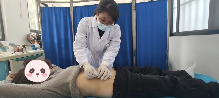 中医埋线巧施治 助力长期便秘患者摆脱困扰